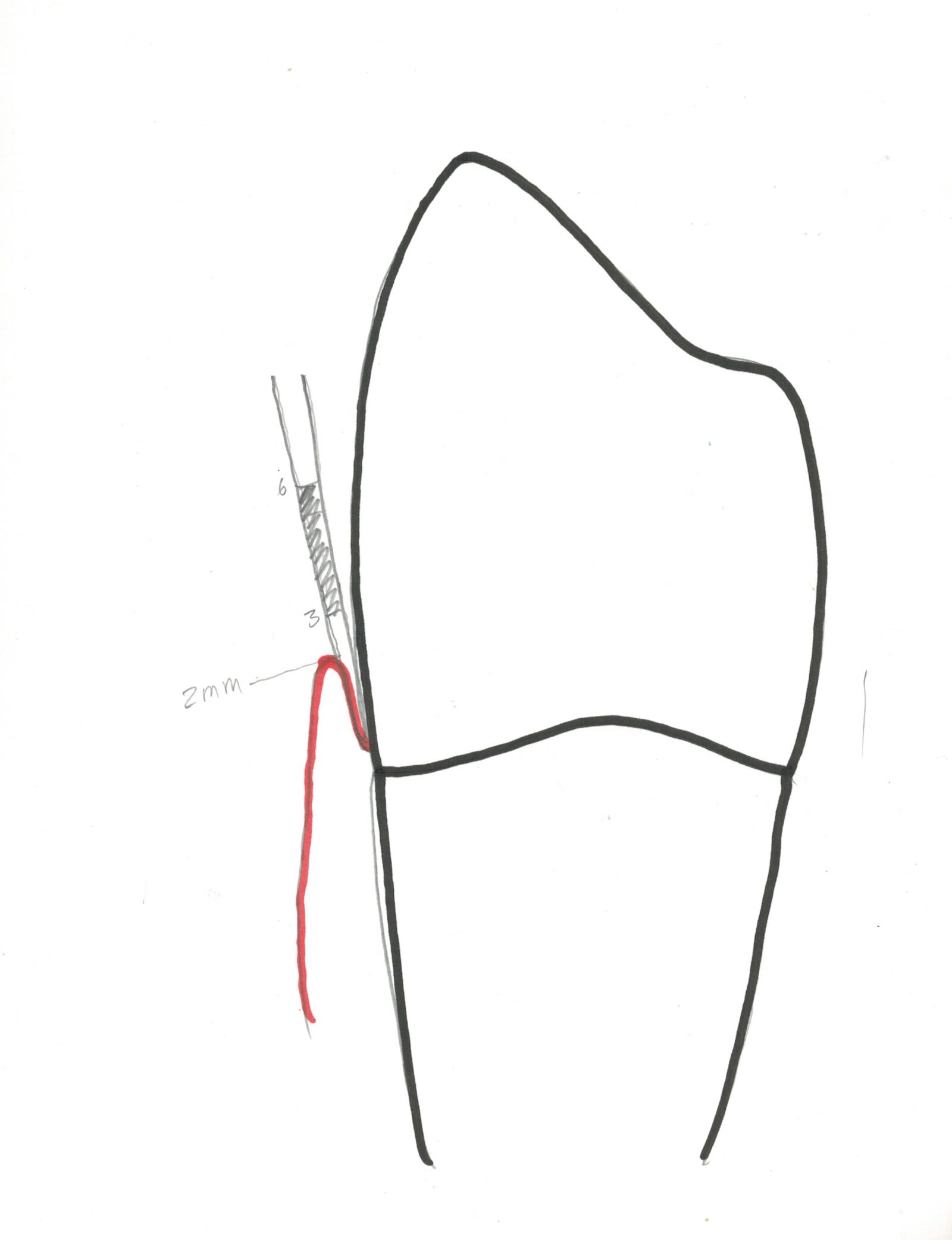 Periodontal Charting IV.4 The Center for Dental Education