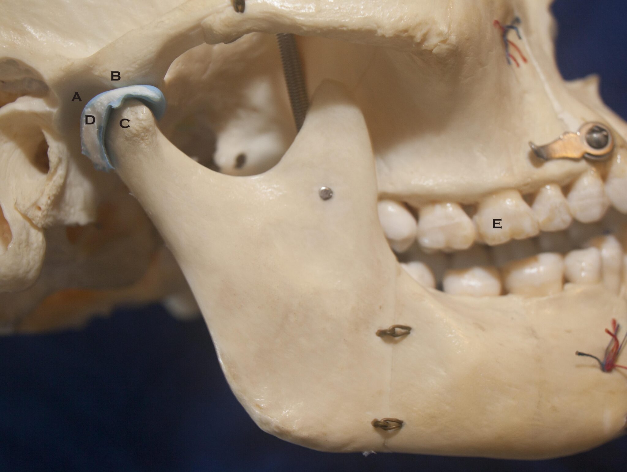 The TMJ (Temporomandibular Joint) - II.4 – The Center for Dental Education